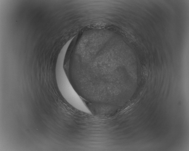 X0000082150818200702092148