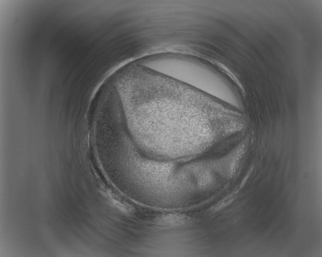 X0000082161117200702092210