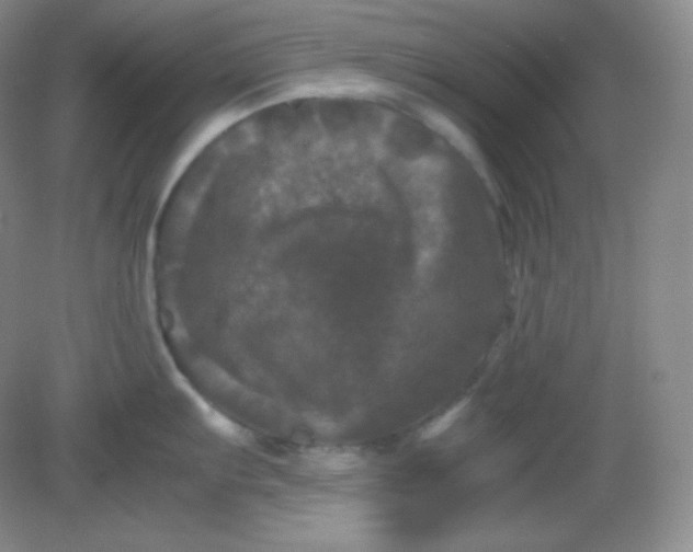 X0000082171103200702021720