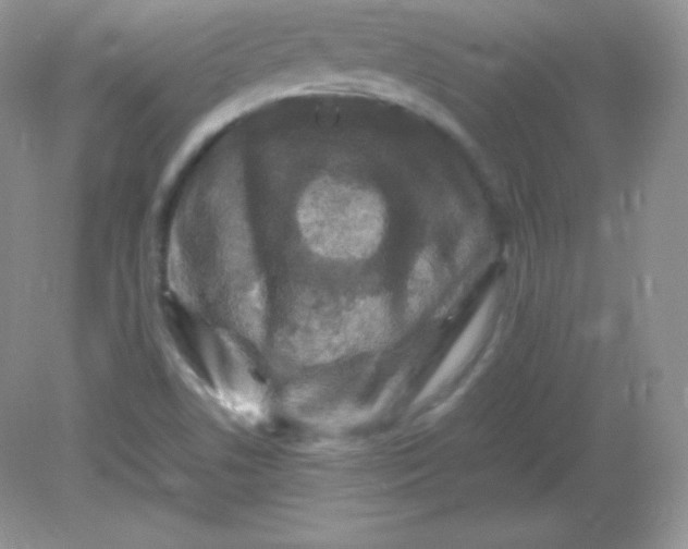 X0000082171506200702021713