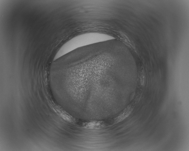 X0000082170366200702092249