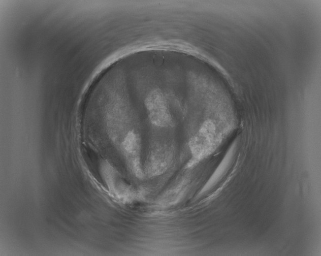 X0000082171506200702092230