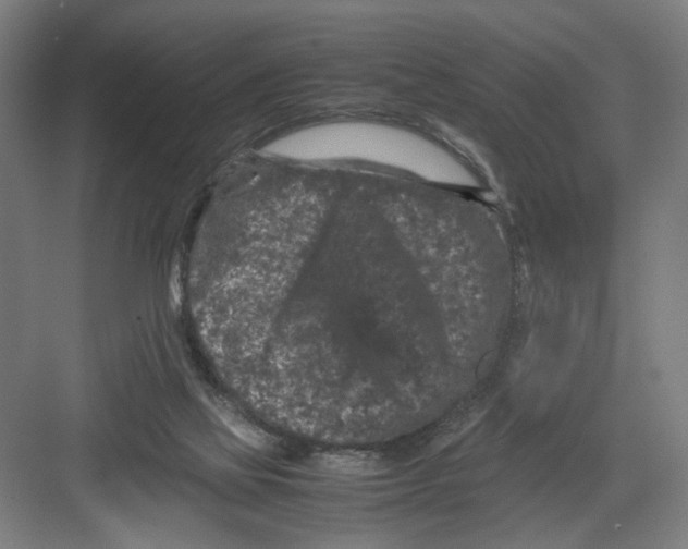 X0000082170069200702162311