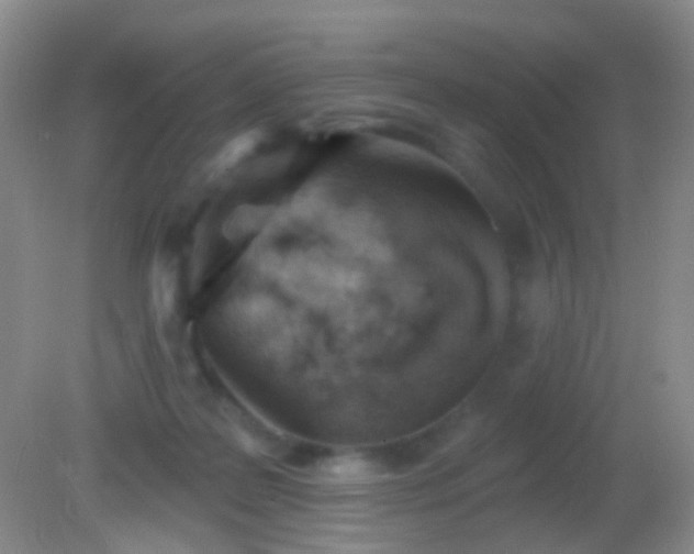 X0000082180219200701270035