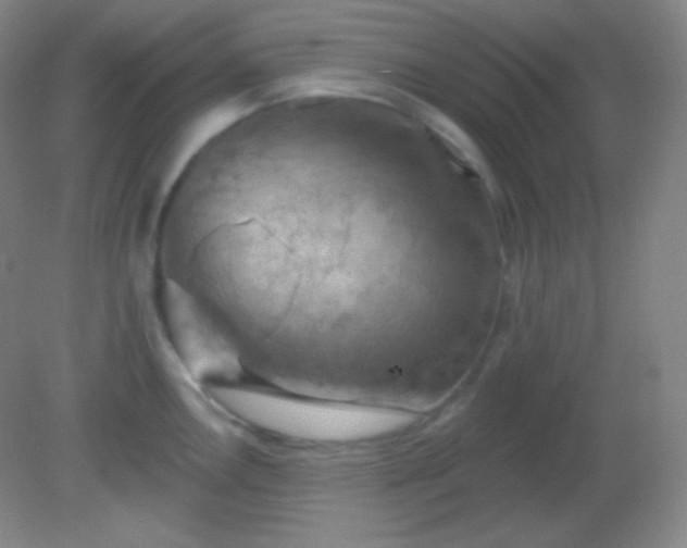 X0000082181146200701270020