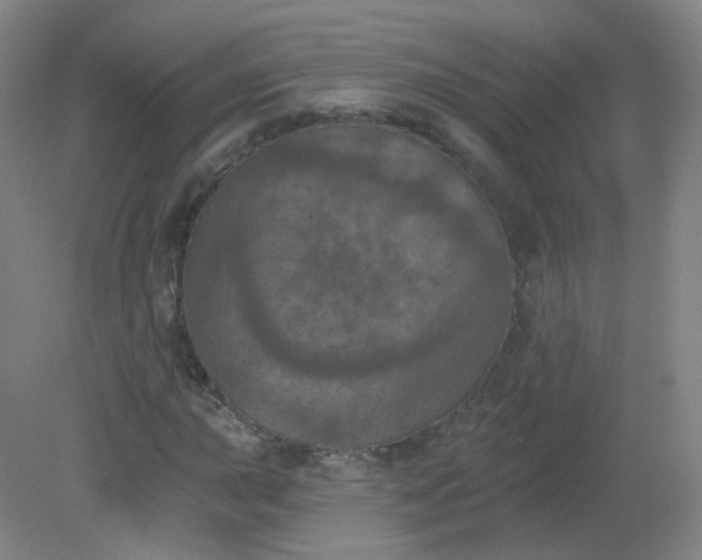 X0000082181015200702021747