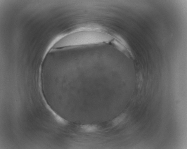 X0000082181103200702021746