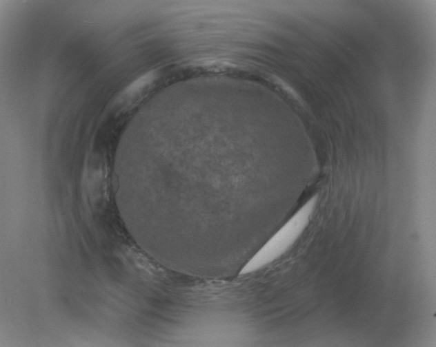 X0000082181111200702021745
