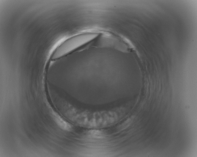 X0000082181463200702021740