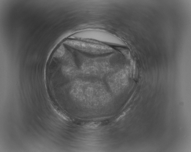 X0000082180148200702092318