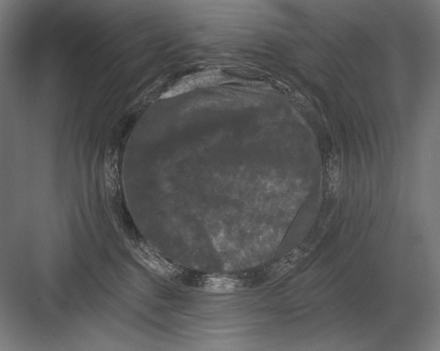 X0000082180376200702092316