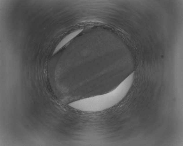 X0000082181014200702092304