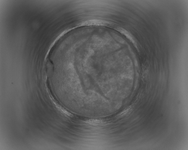 X0000082181075200702092303