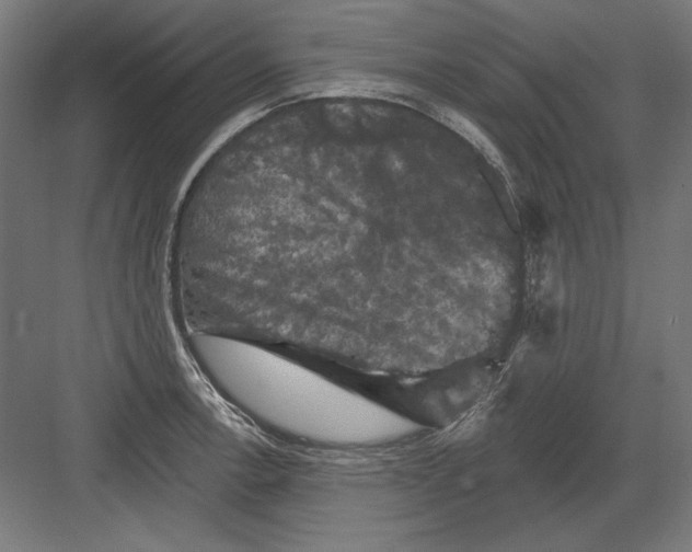 X0000082181138200702092303