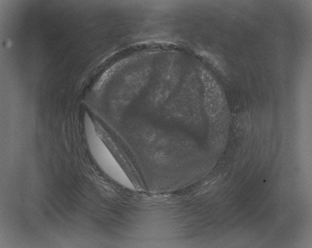 X0000082181159200702092302
