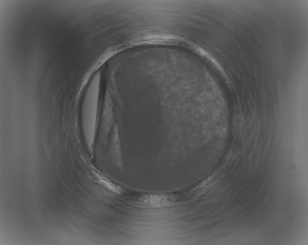 X0000082181362200702092258