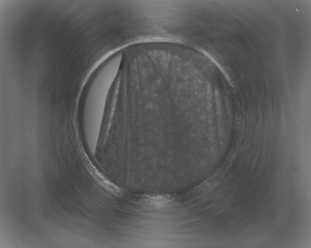 X0000082181460200702092257