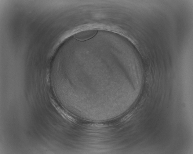 X0000082181499200702092256