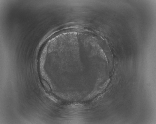 X0000082180150200702162335