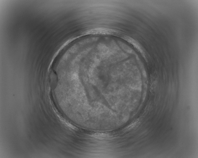 X0000082181075200702162320