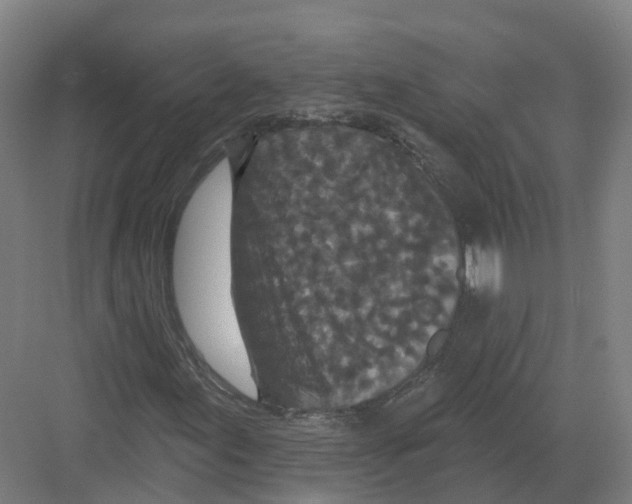 X0000082181155200702162319