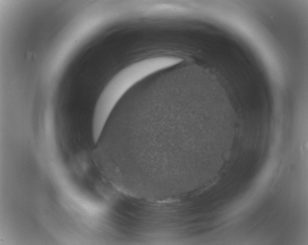 X0000082200765200701270118