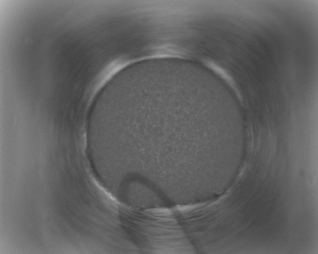 X0000082201415200701270106