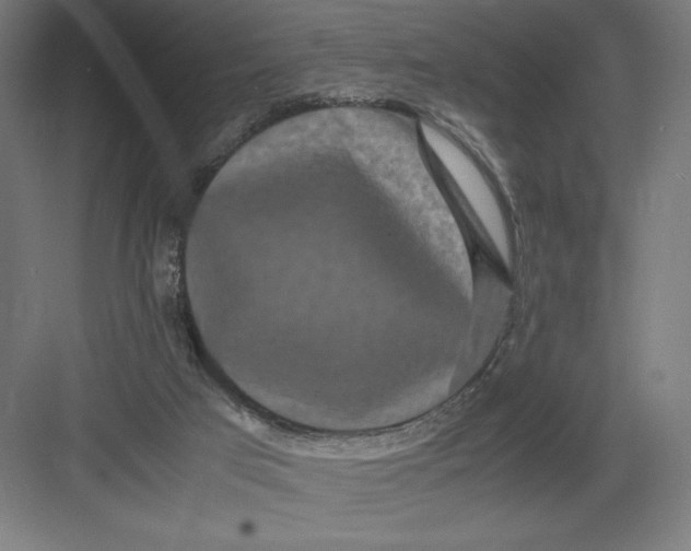 X0000082200017200702100013