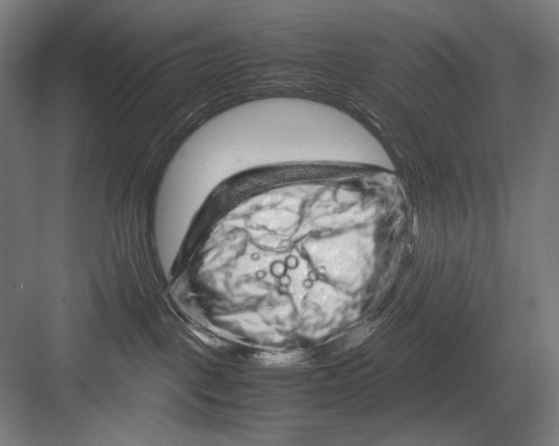 X0000082200093200702100012