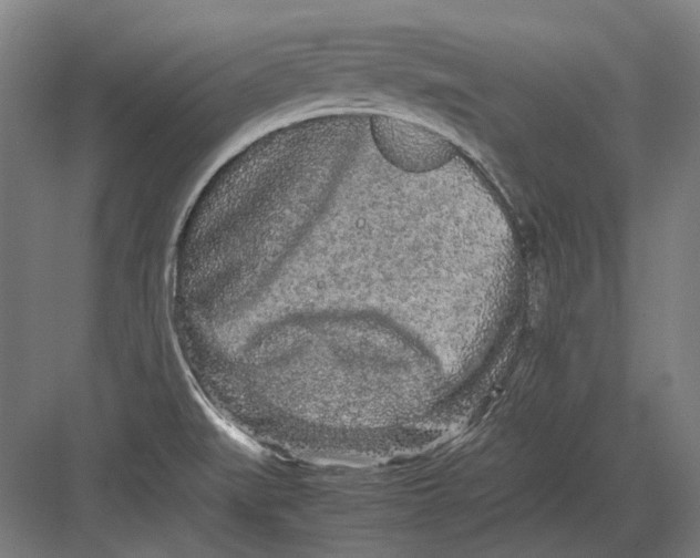 X0000082201519200702092348