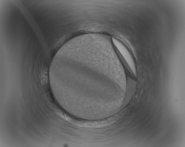 X0000082200017200702170030