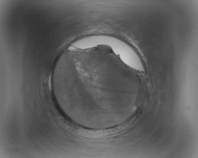 X0000082200019200702170030