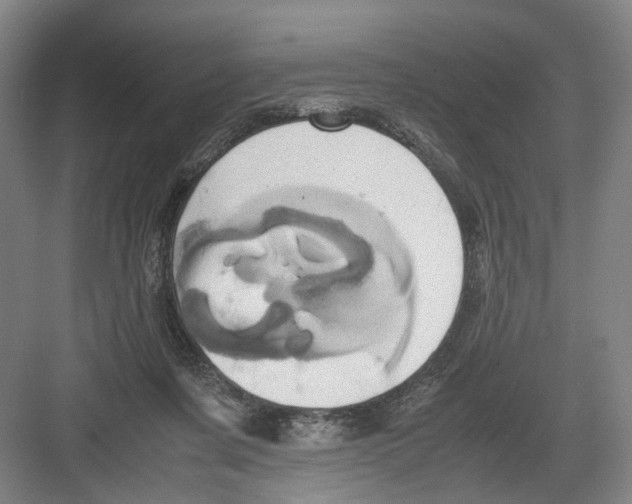 X0000082200311200702170025