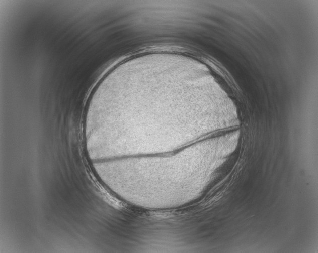 X0000082200852200702170016