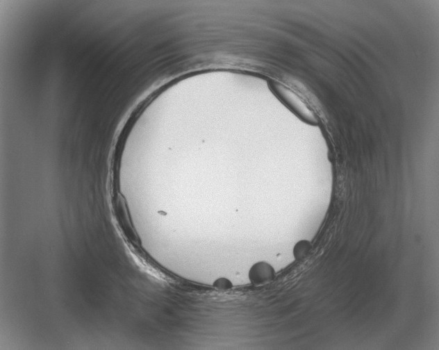 X0000082201136200702170011