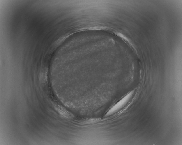 X0000082201161200702170011