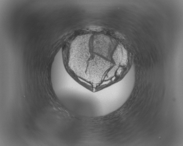 X0000082201397200702170006