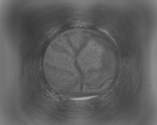 X0000082201399200702170006