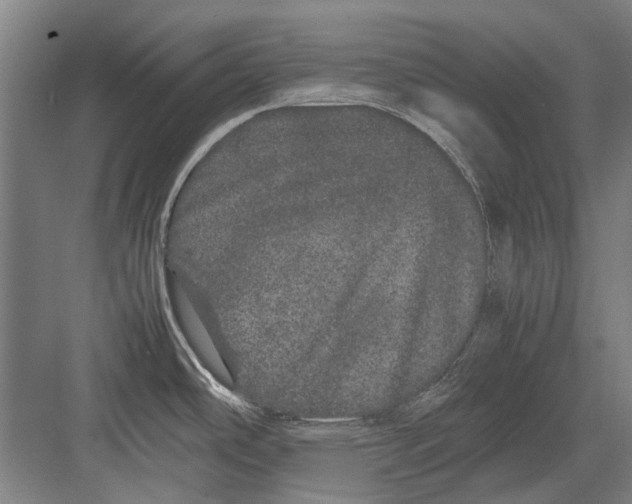 X0000082201486200702170005