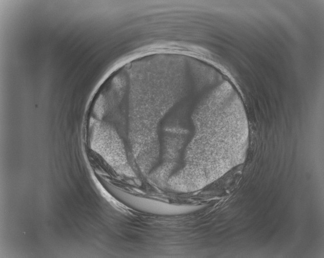 X0000082201531200702170005