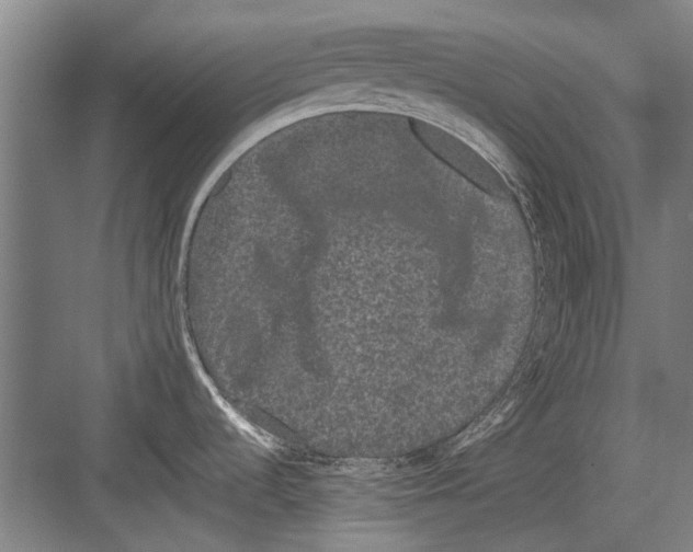 X0000082201536200702170005