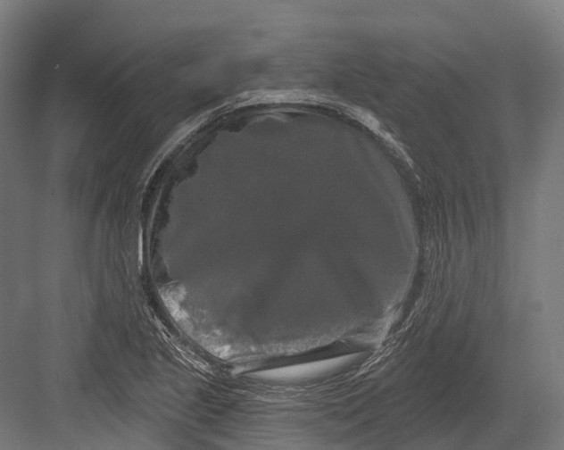 X0000082711221200702161807