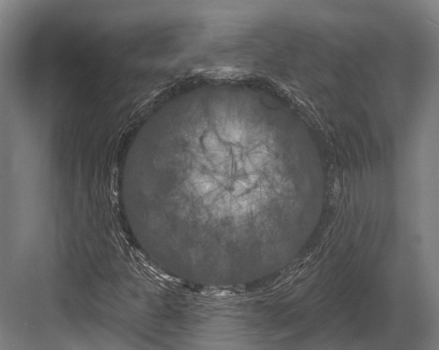 X0000082711301200702161805