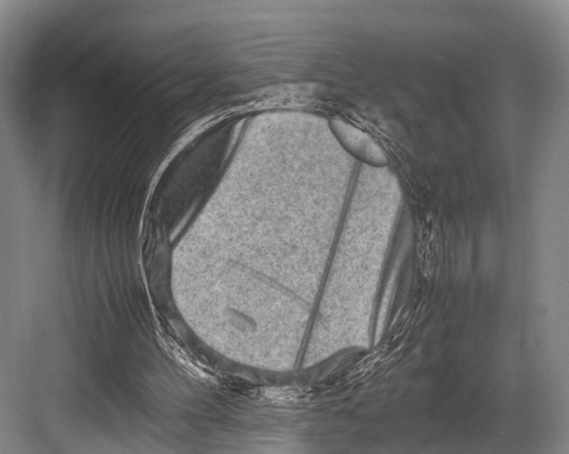 X0000082720100200702161852