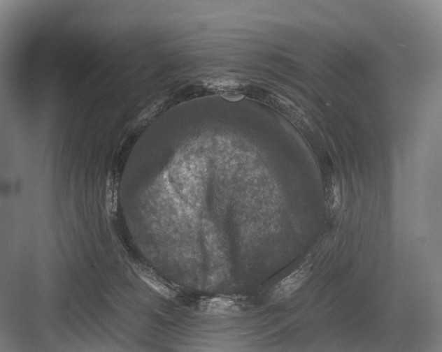 X0000082720180200702161851