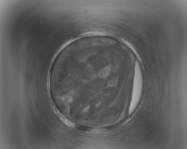 X0000082721179200702161833