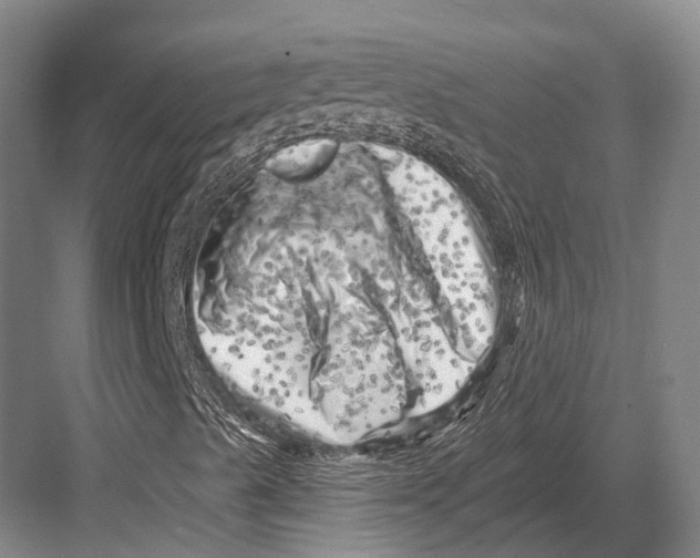 X0000082731489200702161853