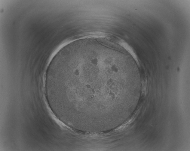 X0000082741099200702091857