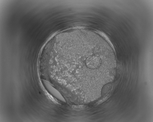 X0000082740859200702161931