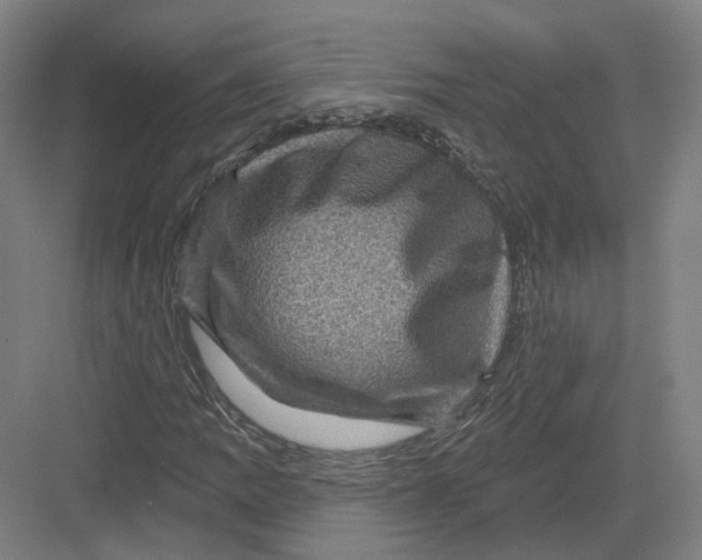 X0000082761109200702162018